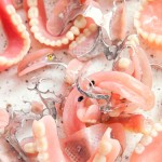 blog_dentures